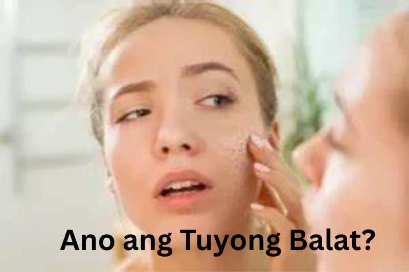 Ano ang Tuyong Balat