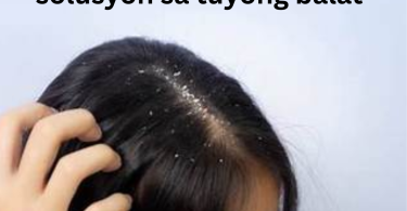solusyon sa tuyong balat