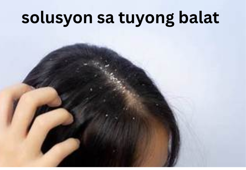 solusyon sa tuyong balat